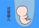 培养潍坊捐卵宝宝艺术细胞的小技巧